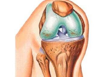 Las principales razones de las articulaciones de la rodilla