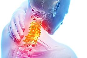 Síntomas de las reglas nutricionales para la osteocondrosis cervical y la enfermedad