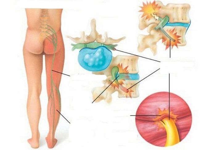 Tipos y causas de dolor
