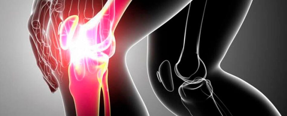 Dolor de rodilla foto 4